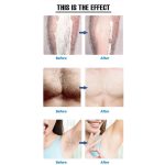 NANO EPILATOR - Slika 4