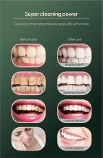 3u1 Ultrazvučni električni čistač zubnog kamenca - Slika 7