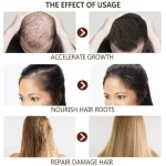 Ulje za oporavak i podsticanje rasta kose - Slika 6