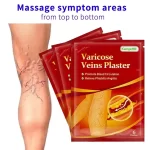 Flasteri za proširene vene 12kom