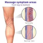 Flasteri za proširene vene 12kom - Slika 3